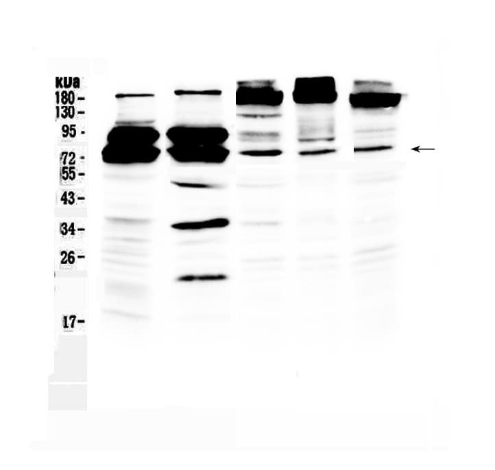 DDX3 / DDX3X Antibody