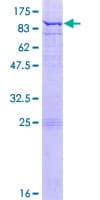 Human ETFDH Protein (Recombinant GST)