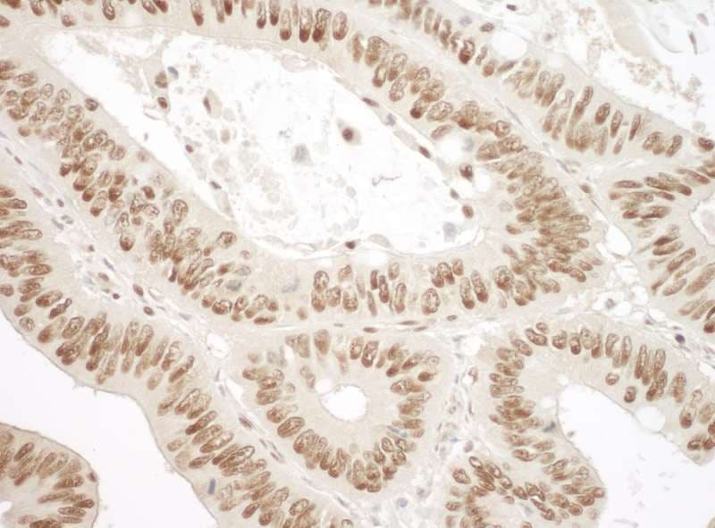 XRCC6 / Ku70 Antibody (aa559-609)