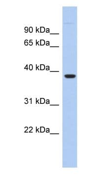 Polyclonal Rabbit anti-Human FITM1 Antibody (N-Terminus, WB)