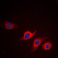 Polyclonal Rabbit anti-Human APOL2 / Apolipoprotein L 2 Antibody (Internal, IHC, IF, WB)