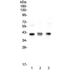 CCR4 Antibody