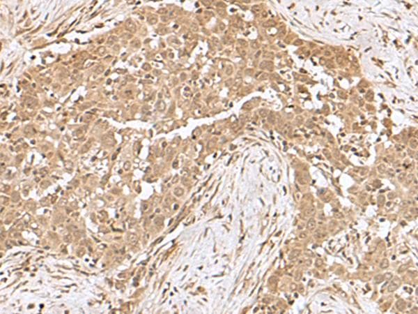 RCHY1 / PIRH2 Antibody