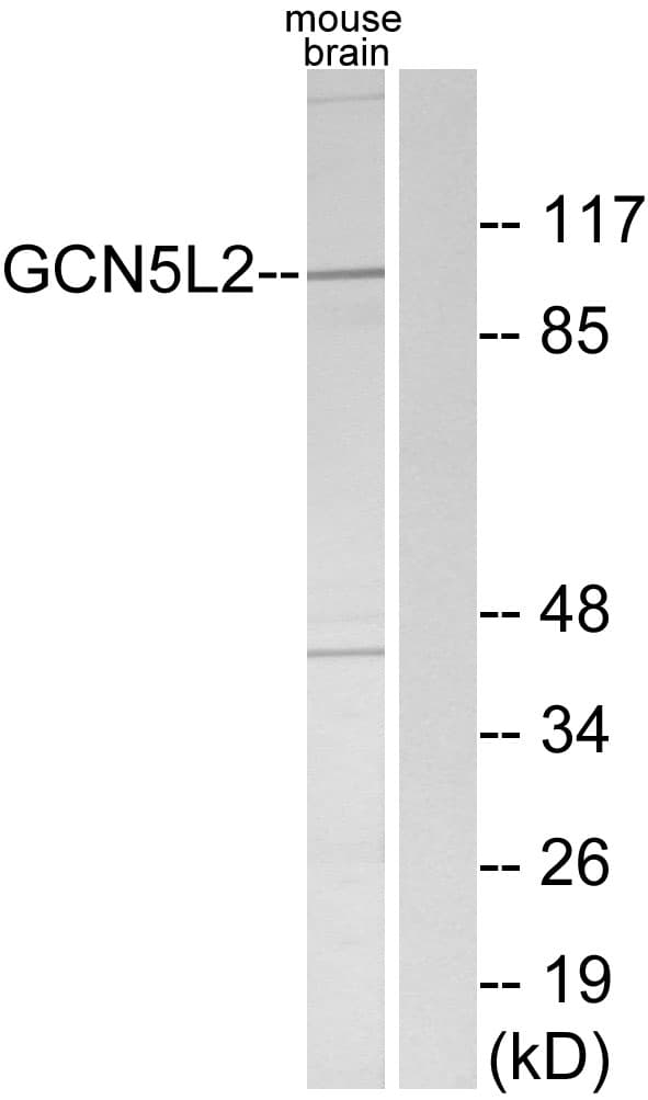 IHC-plus™ KAT2A / GCN5 Antibody (aa691-740)