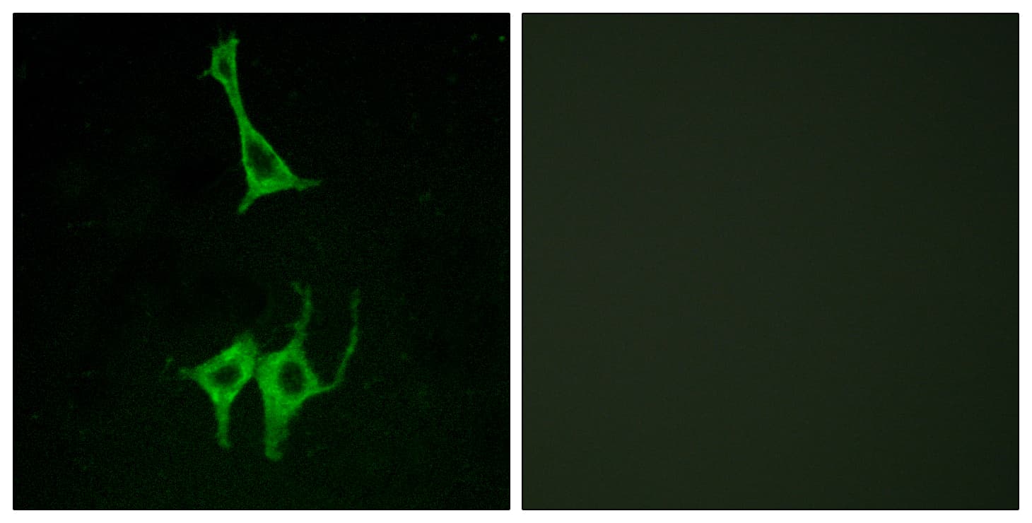 NMUR1 Antibody (aa1-50)