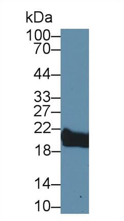 PPIB / Cyclophilin B Antibody (aa34-216, Biotin)