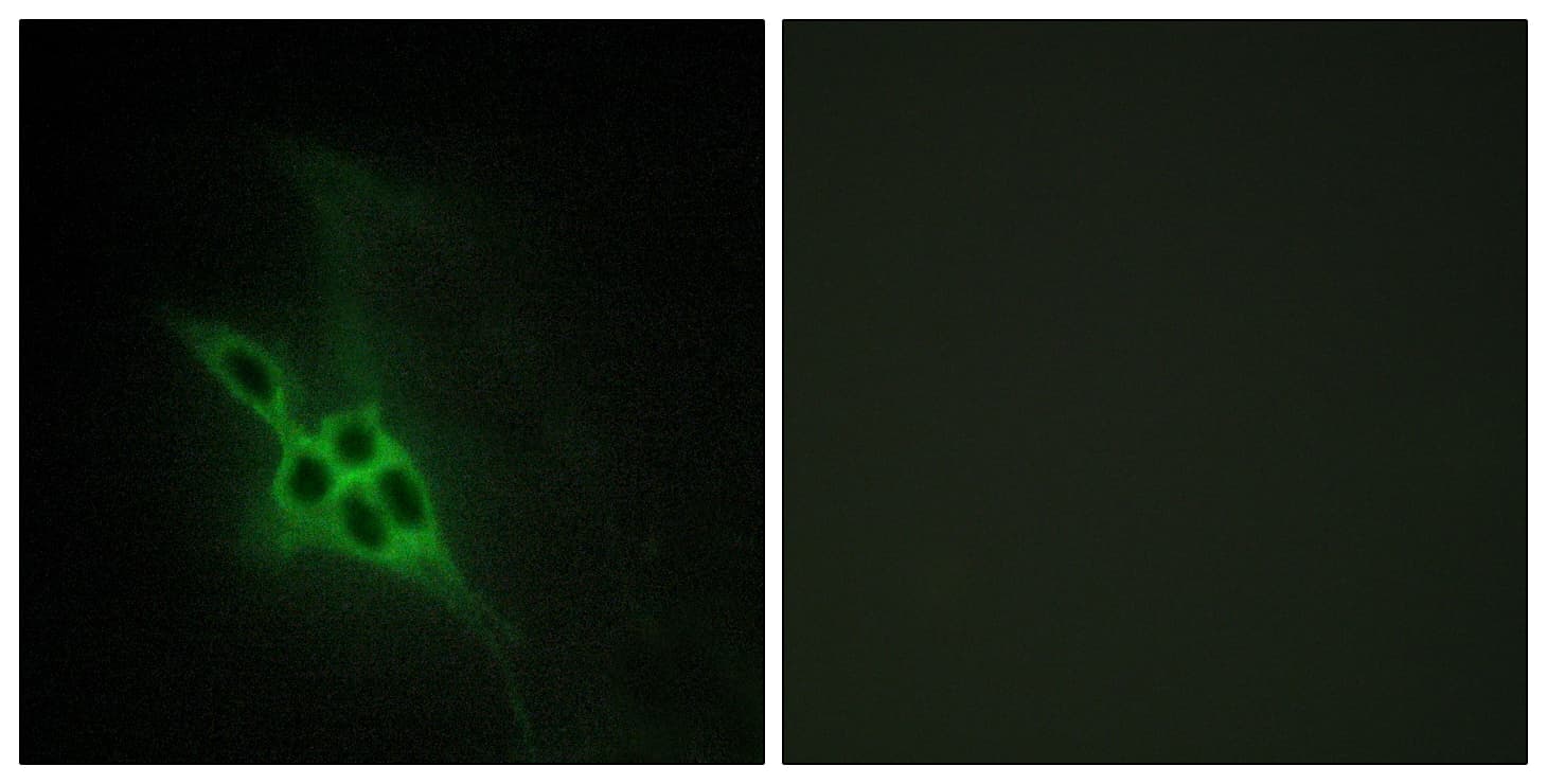 EPH Receptor B1+B2+B3 Antibody (Internal)