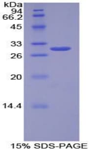 Human LEPR / Leptin Receptor Protein (Recombinant His-T7)