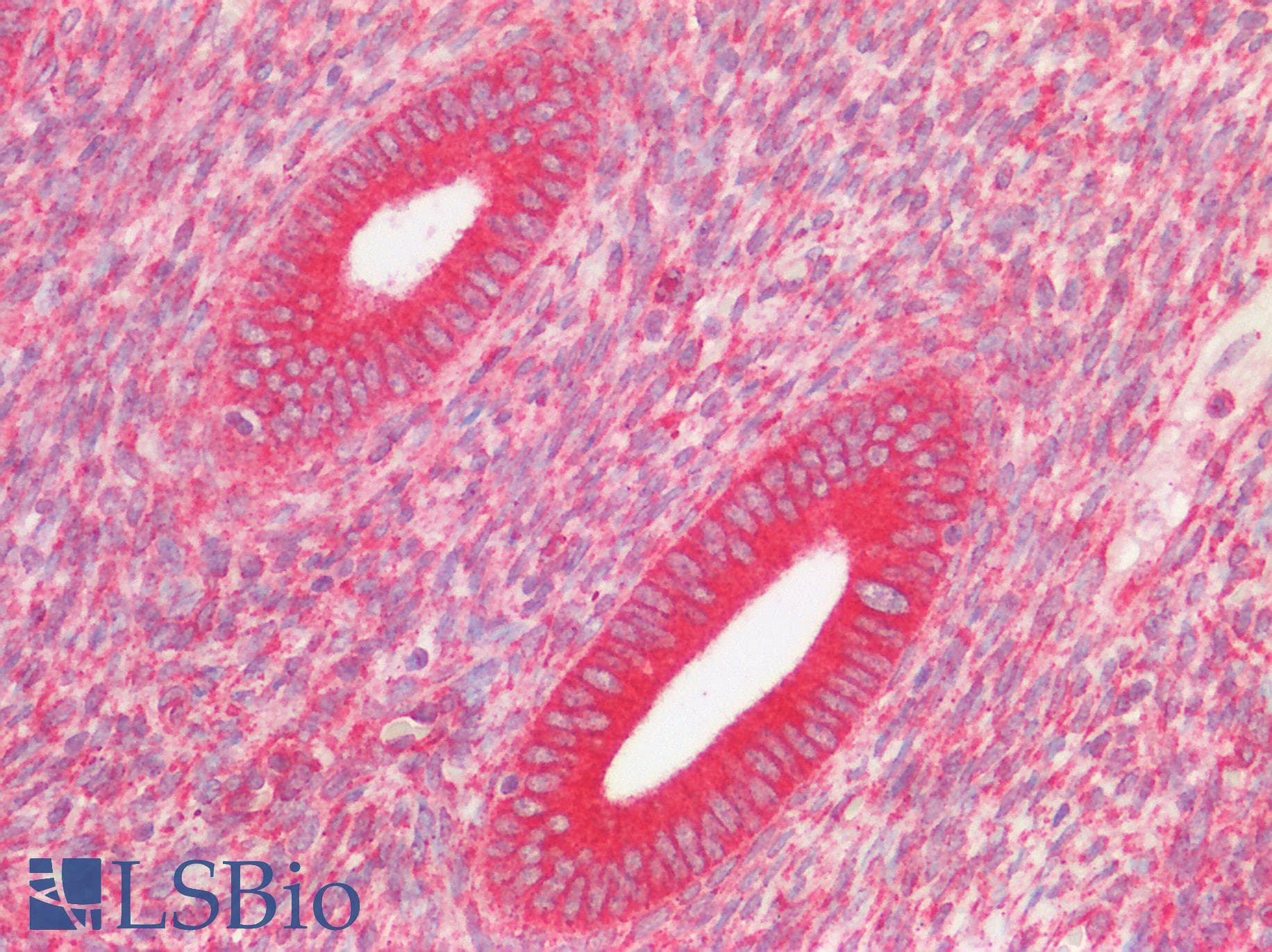 Polyclonal Rabbit anti-Human OS9 Antibody (C-Terminus, IHC, WB)