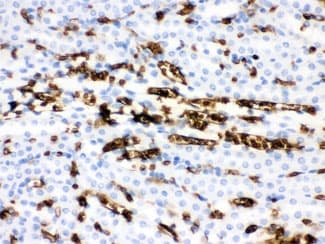 Polyclonal Rabbit anti-Human SLC4A1 / Band 3 / AE1 Antibody (aa28-365, IHC, WB)