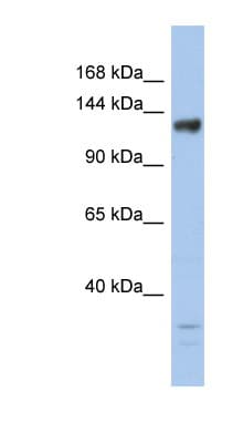 KDM4B / JMJD2B Antibody (aa359-408)