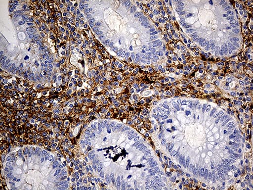PLG / Plasmin / Plasminogen Antibody (aa301-586, clone OTI4F5)