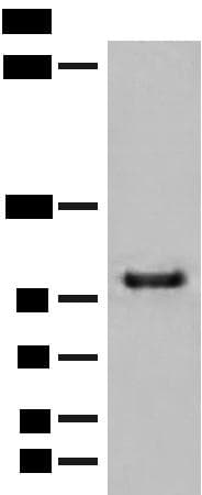 CTDP1 / FCP1 Antibody