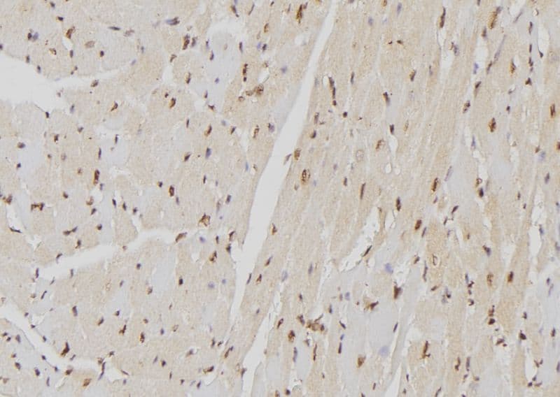 LBR / Lamin B Receptor Antibody