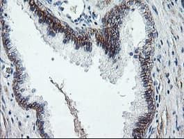 DTNB / Dystrobrevin Beta Antibody (clone OTI3A12)