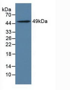 ILT3 / LILRB4 Antibody (aa24-206)