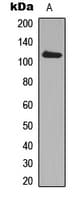 ADAM19 Antibody (Internal)