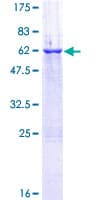 Human EMC2 / TTC35 Protein (Recombinant GST)