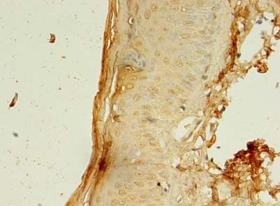 CCDC24 Antibody (Coiled-coil domain)
