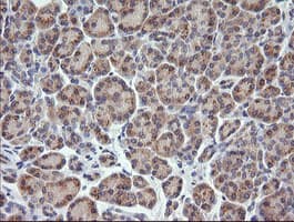 Monoclonal Mouse anti-Human TCL / RHOJ Antibody (clone OTI2C10, IHC, IF, WB)