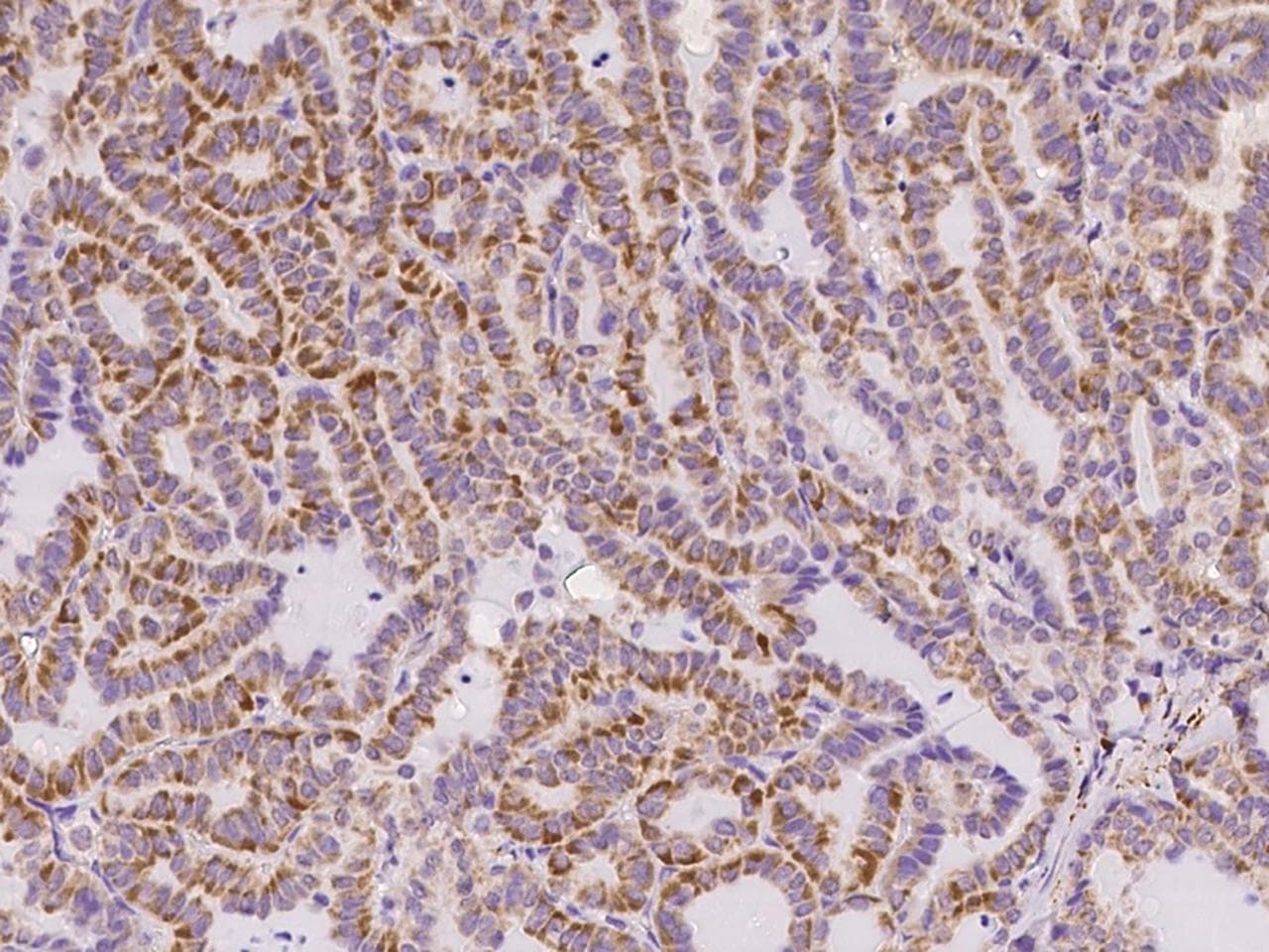 CD135 / FLT3 Antibody