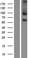 ANTXR1 / TEM8 Protein (Over-Expression Lysate Myc-DDK (Flag))