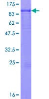 Human IL6R / IL6 Receptor Protein (Recombinant GST)