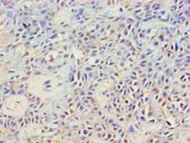 GRB4 / NCK2 Antibody (aa1-380)