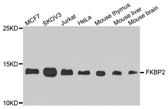 FKBP2 Antibody