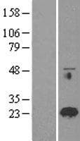 RAB18 Protein (Over-Expression Lysate Myc-DDK (Flag))