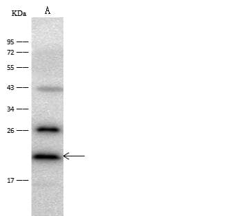 Polyclonal Rabbit anti-Human CRYAB / Alpha B Crystallin Antibody (Preservative Free, IHC, WB)