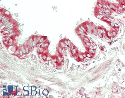 IHC-plus™ Polyclonal Rabbit anti-Human RPL7 / Ribosomal Protein L7 Antibody (C-Terminus, IHC, WB)