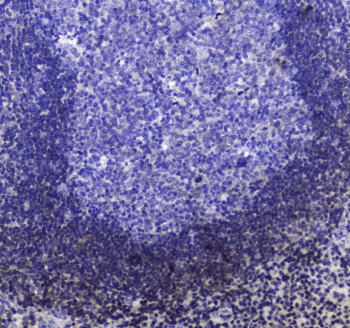 INPP5D / SHIP1 / SHIP Antibody