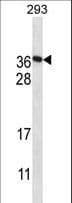 Polyclonal Rabbit anti-Human FAM122A Antibody (aa108-136, WB)
