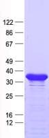 Human ZNF705D Protein (Recombinant His, N-Terminal)
