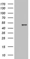 KRT20 / CK20 / Cytokeratin 20 Antibody (clone OTI6F6)