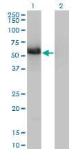 IHC-plus™ GIT2 Antibody (clone 3B5-B9)