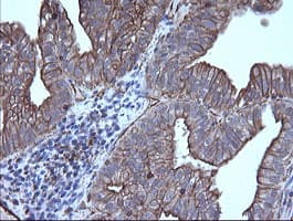 TRIM38 Antibody (clone OTI14B4)