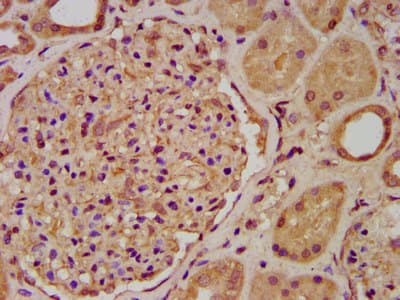 ENOSF1 Antibody