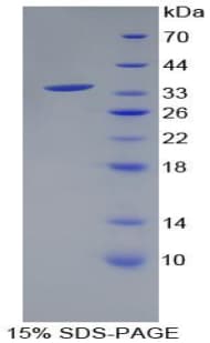 Human HSD17 / HSD17B1 Protein (Recombinant His-T7)