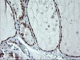 CMPK / CMPK1 Antibody (clone OTI1A1)