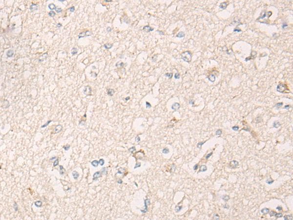 IBA57 / C1orf69 Antibody