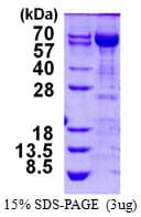 Human TKT / Transketolase Protein (Recombinant His)