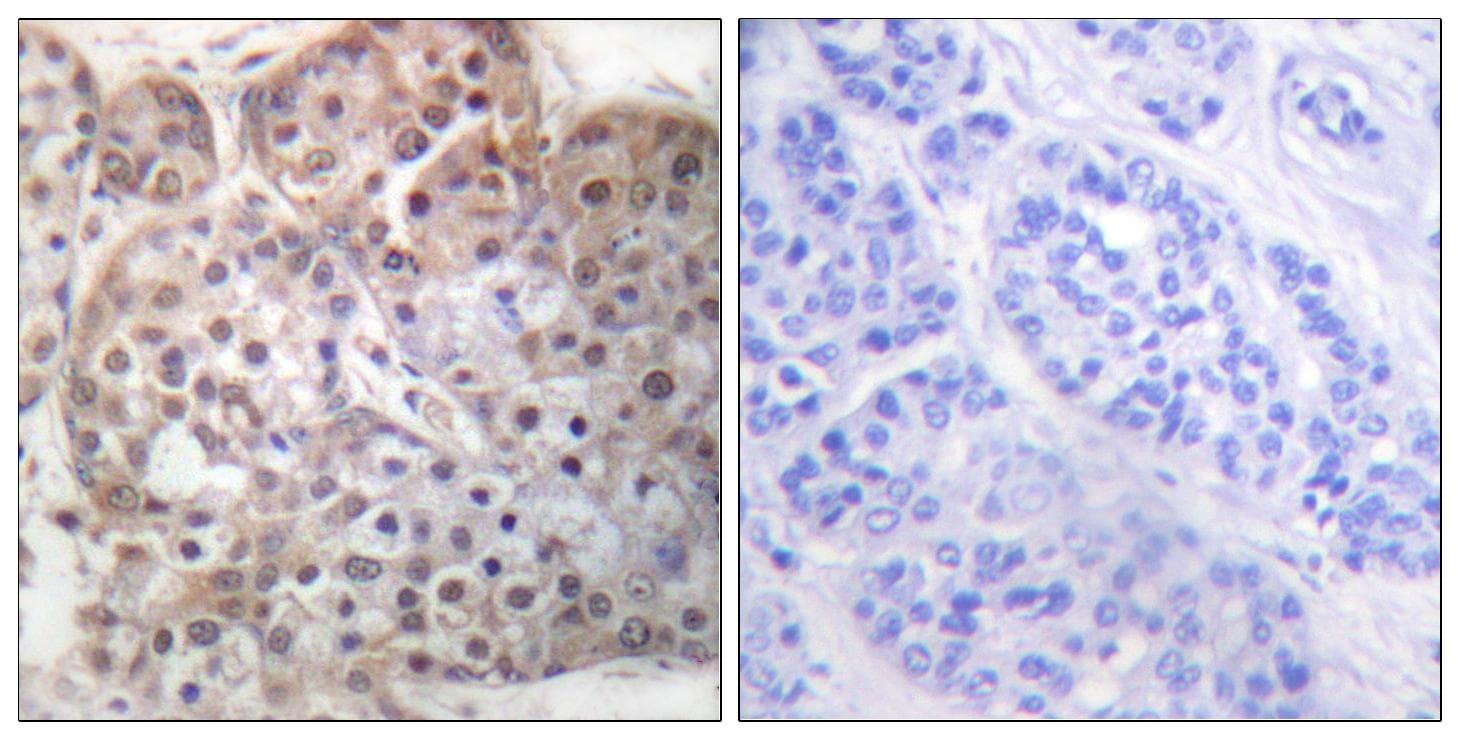 Polyclonal Rabbit anti-Human STAT5A Antibody (phospho-Ser725, IHC, IF, WB)