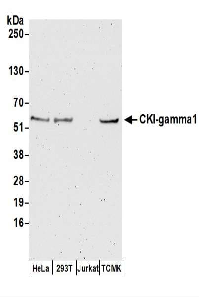 Polyclonal Rabbit anti-Human CSNK1G1 / CKI-Gamma 1 Antibody (aa1-50, WB)