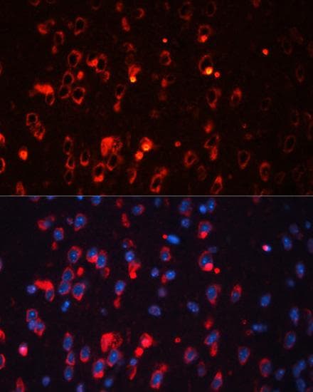 KCNA1 / Kv1.1 Antibody