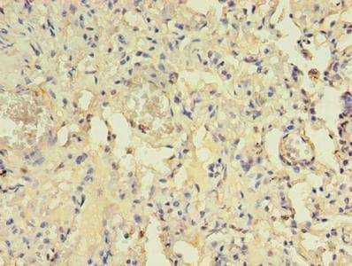 CENTB1 / ACAP1 Antibody