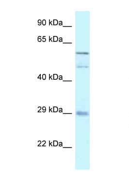 GFRA4 Antibody (aa182-231)