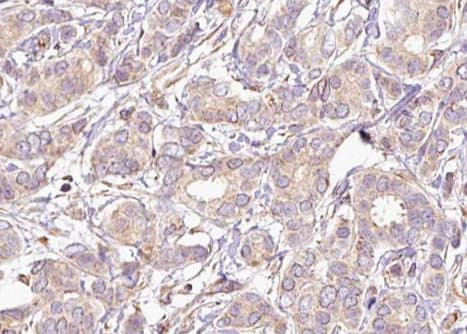 MAP2K2 / MKK2 / MEK2 Antibody (phospho-Thr394)