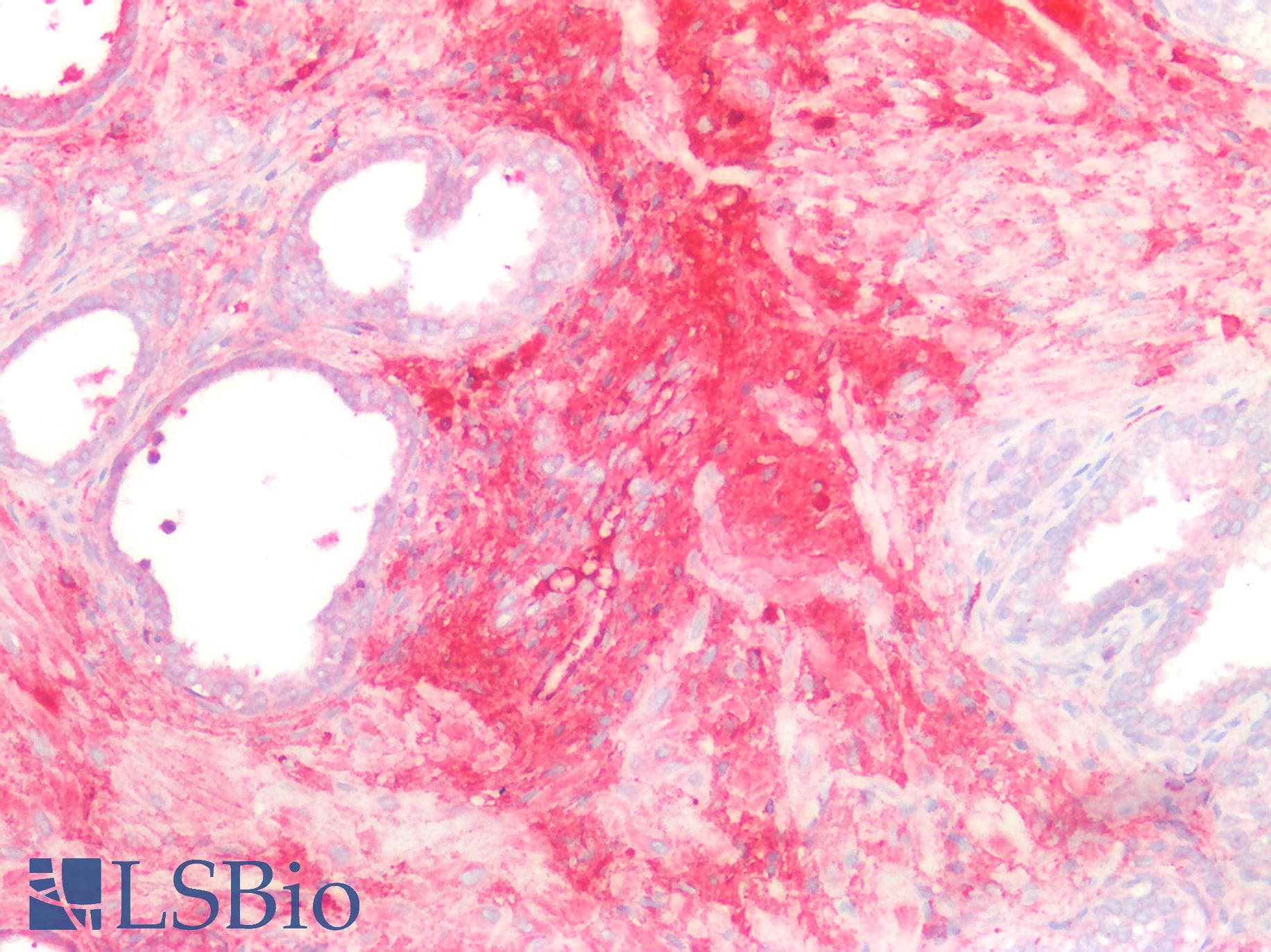 Polyclonal Rabbit anti-Mouse GLMP / C1orf85 Antibody (aa246-404, IHC, WB)